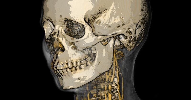 Illustrative Volume Rendering
